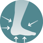 Rückfuß stilisiert mit Markern für die Verletzungen